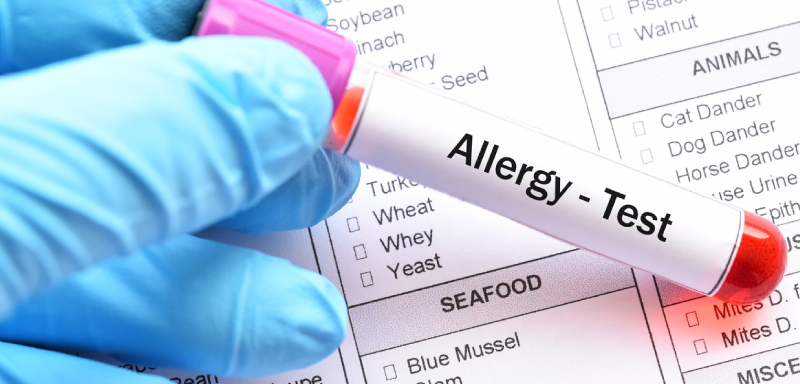 Analyse d'Allergies