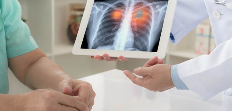 Test de Respiration Pulmonaire